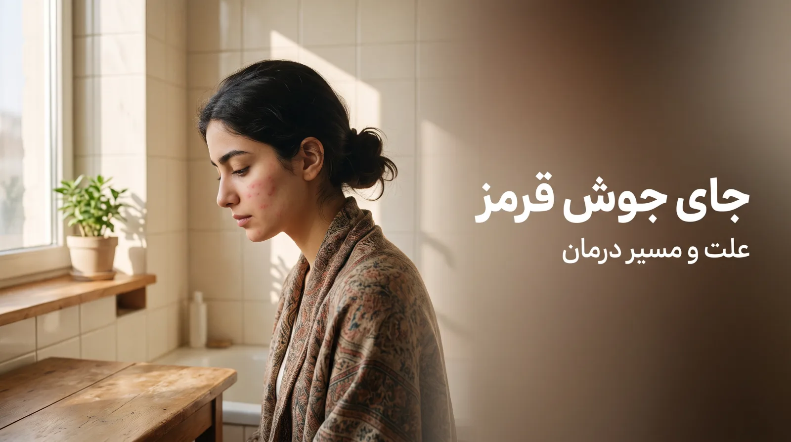 زن جوان ایرانی کنار پنجره با چند لکه‌ی صورتی صاف روی گونه که بعد از خوب شدن جوش مانده است