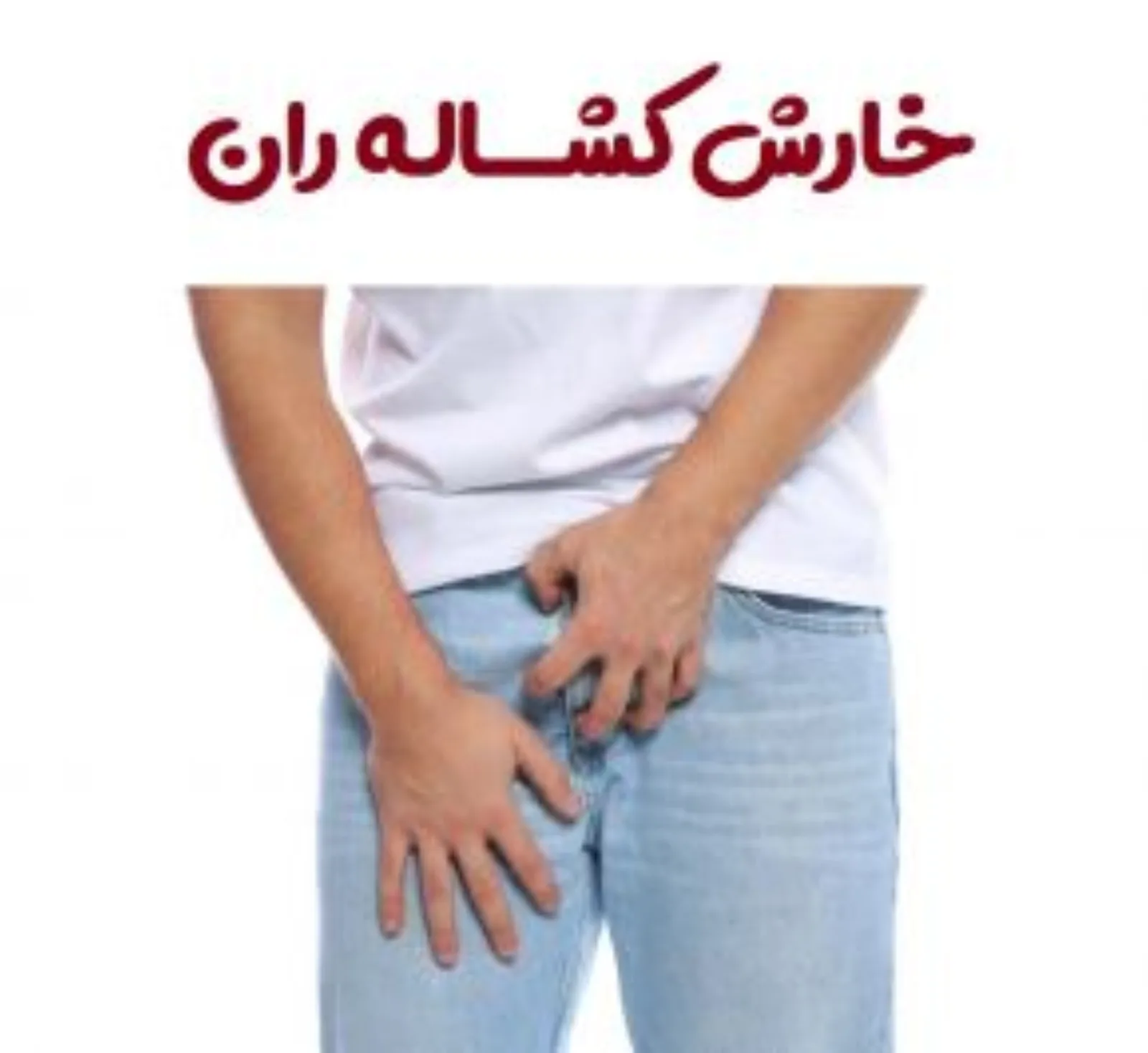 خارش کشاله ران