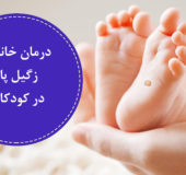 درمان خانگی زگیل پا در کودکان