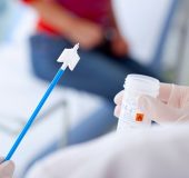 آزمایش hpv