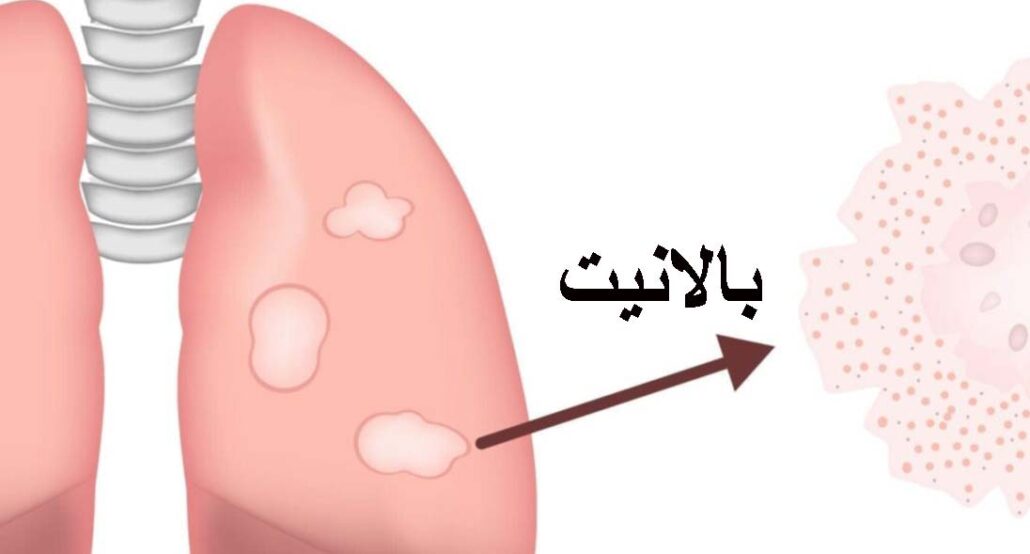 عکس ترک پوست در ناحیه تناسلی مردان